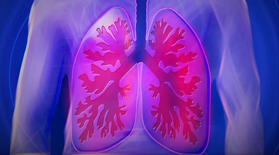 clean fuel cell power - image of lungs